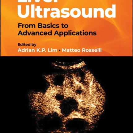 Liver Ultrasound