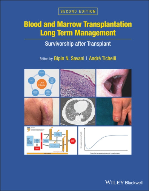 Blood and Marrow Transplantation Long Term Management: Survivorship after Transplant