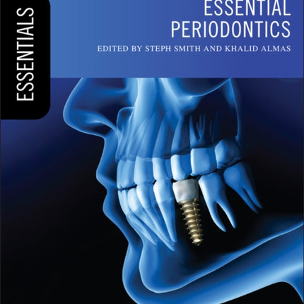 Essential Periodontics