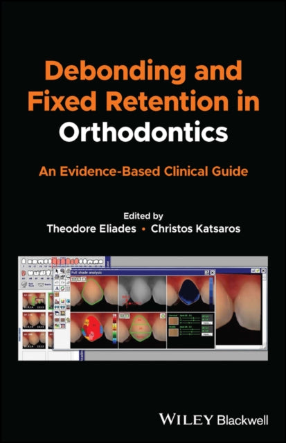 Debonding and Fixed Retention in Orthodontics: An Evidence-Based Clinical Guide