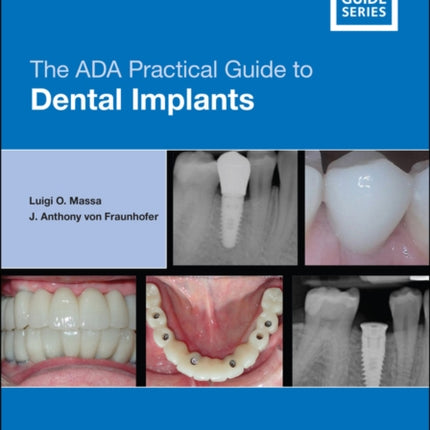 The ADA Practical Guide to Dental Implants