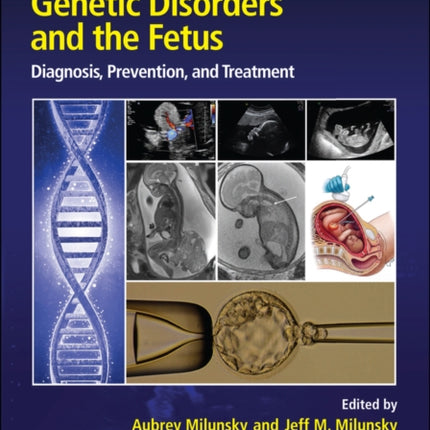 Genetic Disorders and the Fetus: Diagnosis, Prevention and Treatment