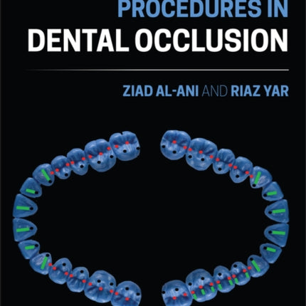 Practical Procedures in Dental Occlusion