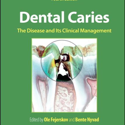 Dental Caries