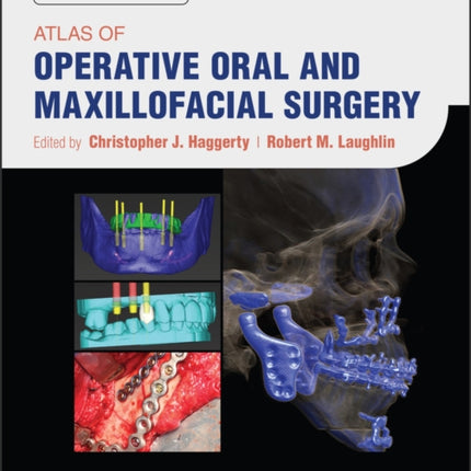 Atlas of Operative Oral and Maxillofacial Surgery