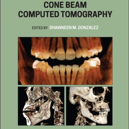 Interpretation Basics of Cone Beam Computed Tomography