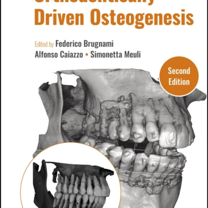 Orthodontically Driven Osteogenesis