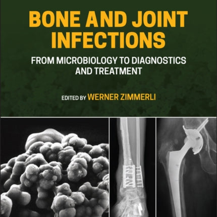 Bone and Joint Infections: From Microbiology to Diagnostics and Treatment