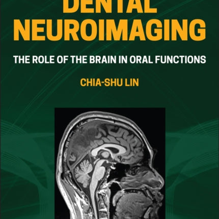 Dental Neuroimaging