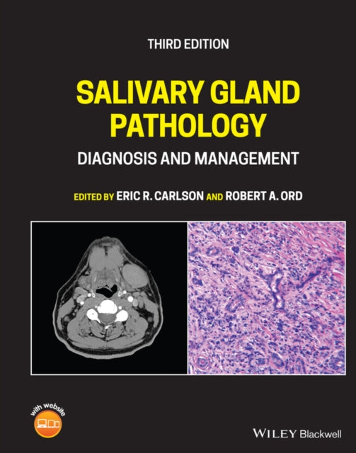 Salivary Gland Pathology: Diagnosis and Management