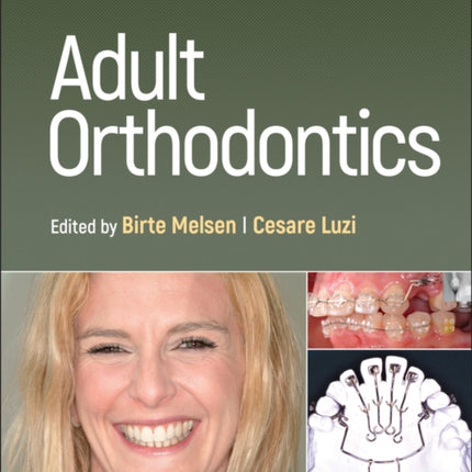 Adult Orthodontics