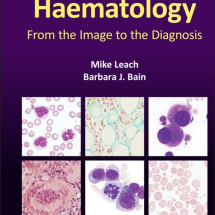 Haematology: From the Image to the Diagnosis