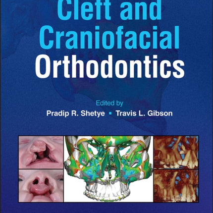 Cleft and Craniofacial Orthodontics