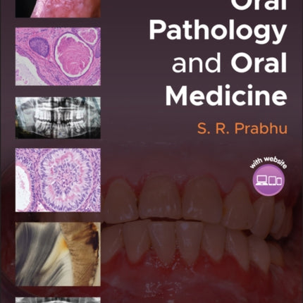 Handbook of Oral Pathology and Oral Medicine