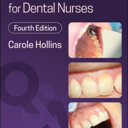 Questions and Answers for Dental Nurses