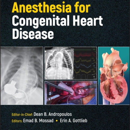 Anesthesia for Congenital Heart Disease