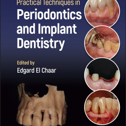 Practical Techniques in Periodontics and Implant Dentistry