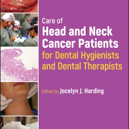 Care of Head and Neck Cancer Patients for Dental Hygienists and Dental Therapists