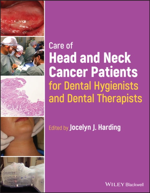 Care of Head and Neck Cancer Patients for Dental Hygienists and Dental Therapists