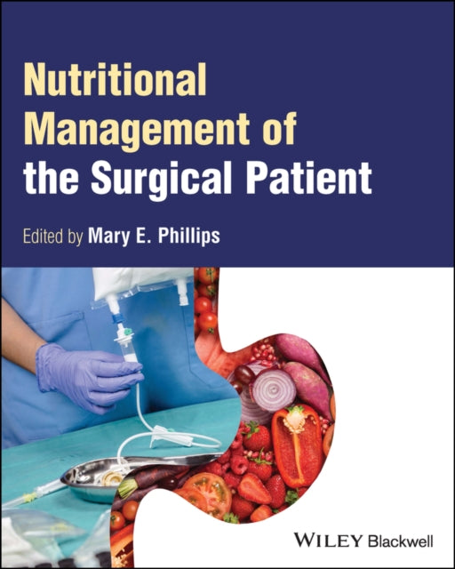 Nutritional Management of the Surgical Patient