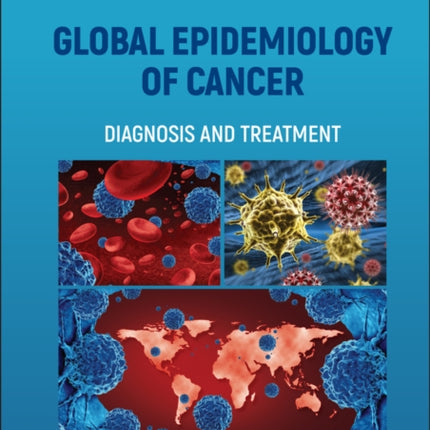 Global Epidemiology of Cancer: Diagnosis and Treatment