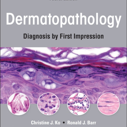 Dermatopathology: Diagnosis by First Impression