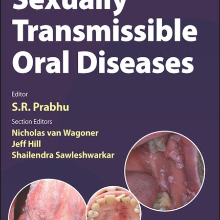 Sexually Transmissible Oral Diseases