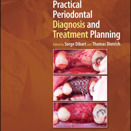 Practical Periodontal Diagnosis and Treatment Planning