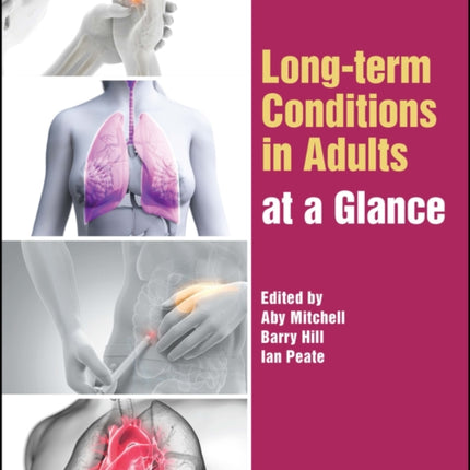 Long-term Conditions in Adults at a Glance