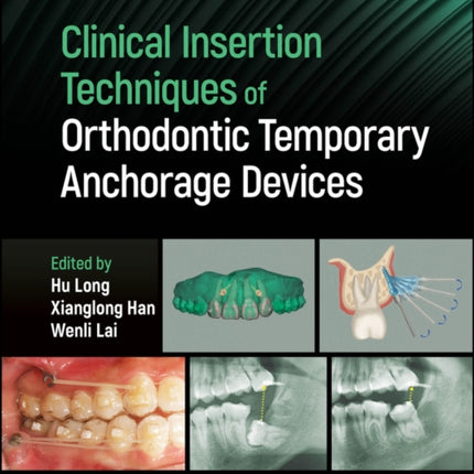 Clinical Insertion Techniques of Orthodontic Temporary Anchorage Devices