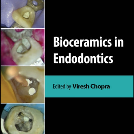 Bioceramics in Endodontics