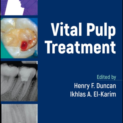 Vital Pulp Treatment