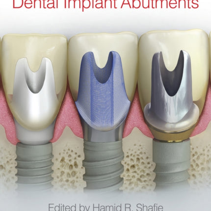 Clinical and Laboratory Manual of Dental Implant Abutments