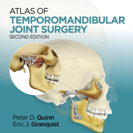 Atlas of Temporomandibular Joint Surgery