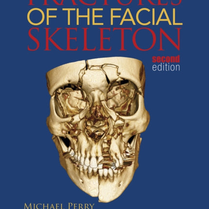 Fractures of the Facial Skeleton