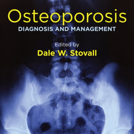 Osteoporosis: Diagnosis and Management