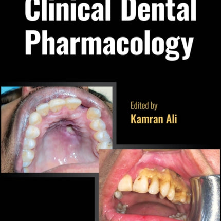 Clinical Dental Pharmacology