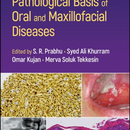 Pathological Basis of Oral and Maxillofacial