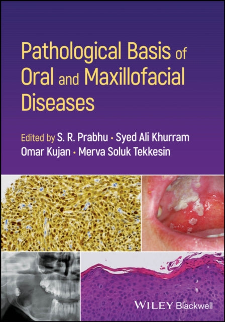 Pathological Basis of Oral and Maxillofacial