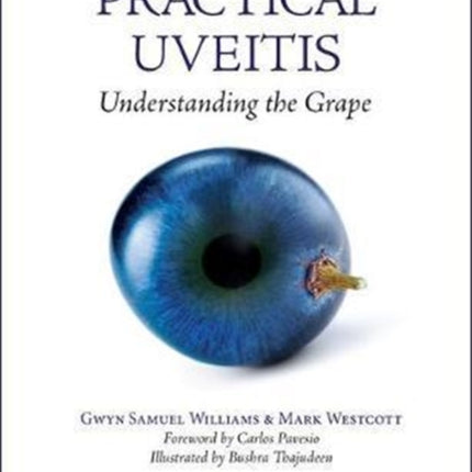 Practical Uveitis