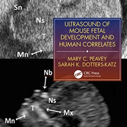 Ultrasound of Mouse Fetal Development and Human Correlates