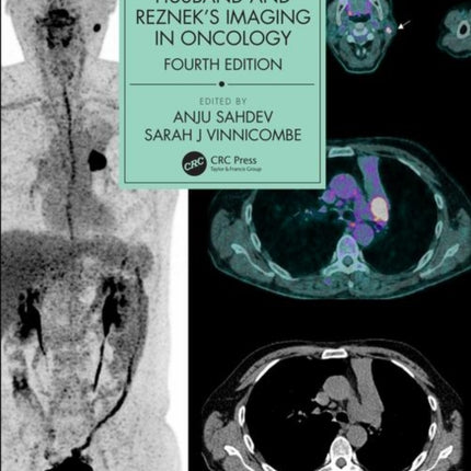 Husband & Reznek's Imaging in Oncology