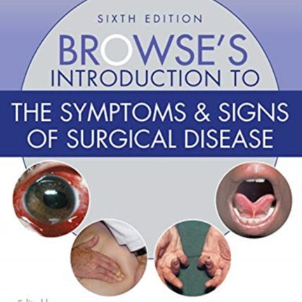 Browse's Introduction to the Symptoms & Signs of Surgical Disease