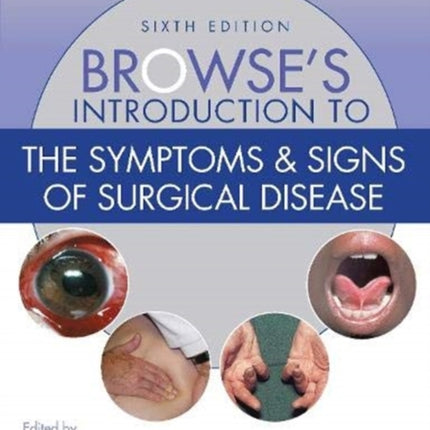 Browse's Introduction to the Symptoms & Signs of Surgical Disease