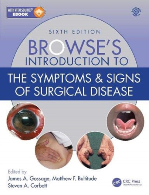 Browse's Introduction to the Symptoms & Signs of Surgical Disease