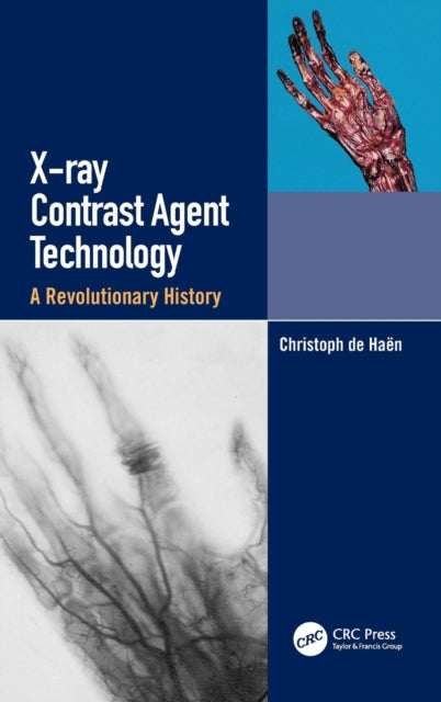 X-ray Contrast Agent Technology: A Revolutionary History