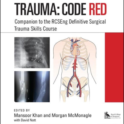 Trauma: Code Red: Companion to the RCSEng Definitive Surgical Trauma Skills Course