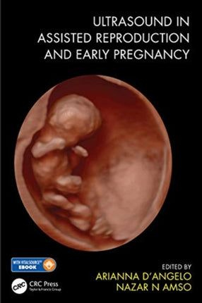 Ultrasound in Assisted Reproduction and Early Pregnancy