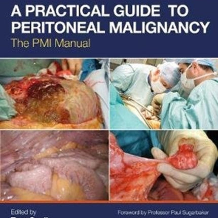 A Practical Guide to Peritoneal Malignancy: The PMI Manual