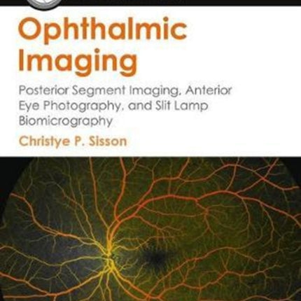 Ophthalmic Imaging